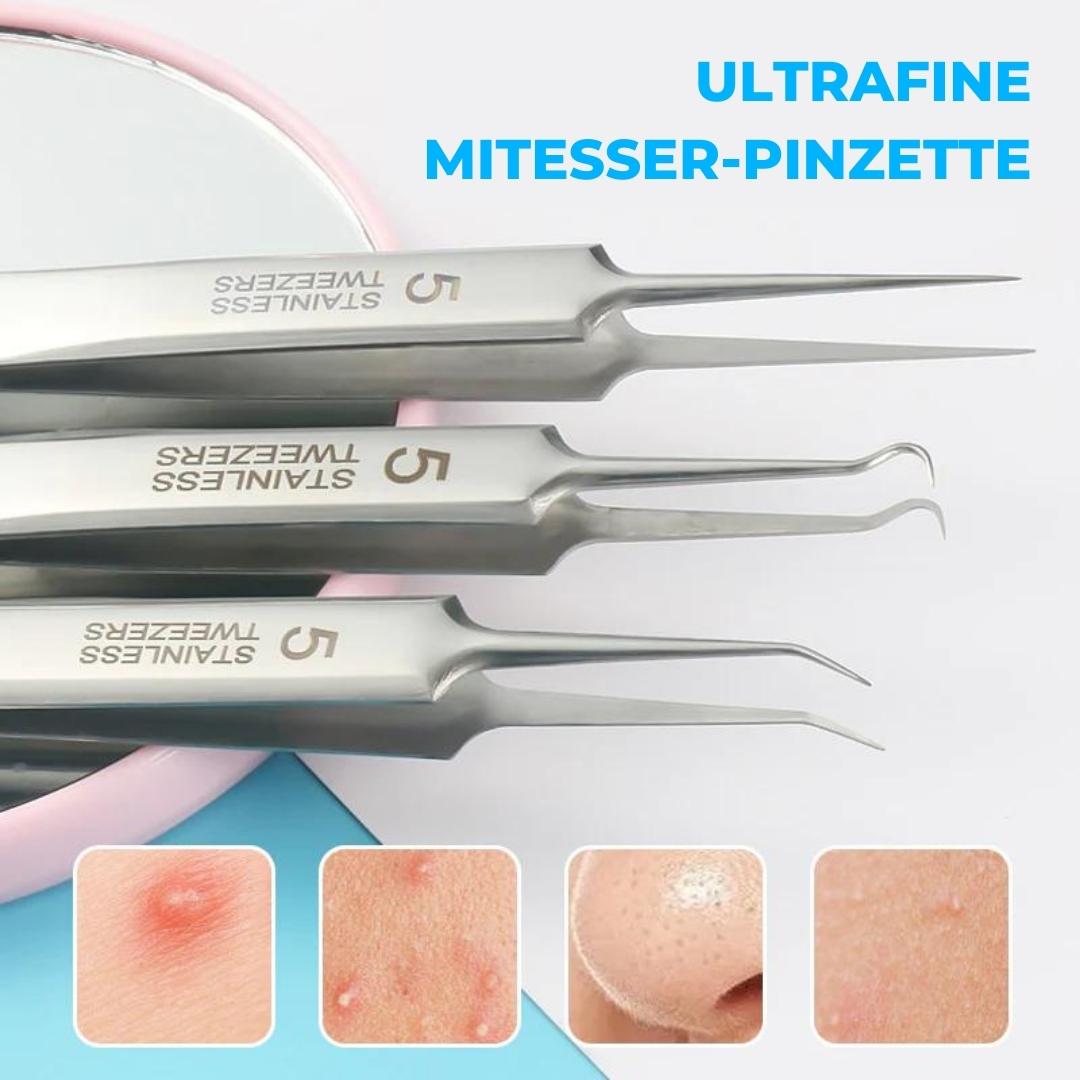 ClearSkin™ - Ultradunne mee-eter pincetten voor je gezicht