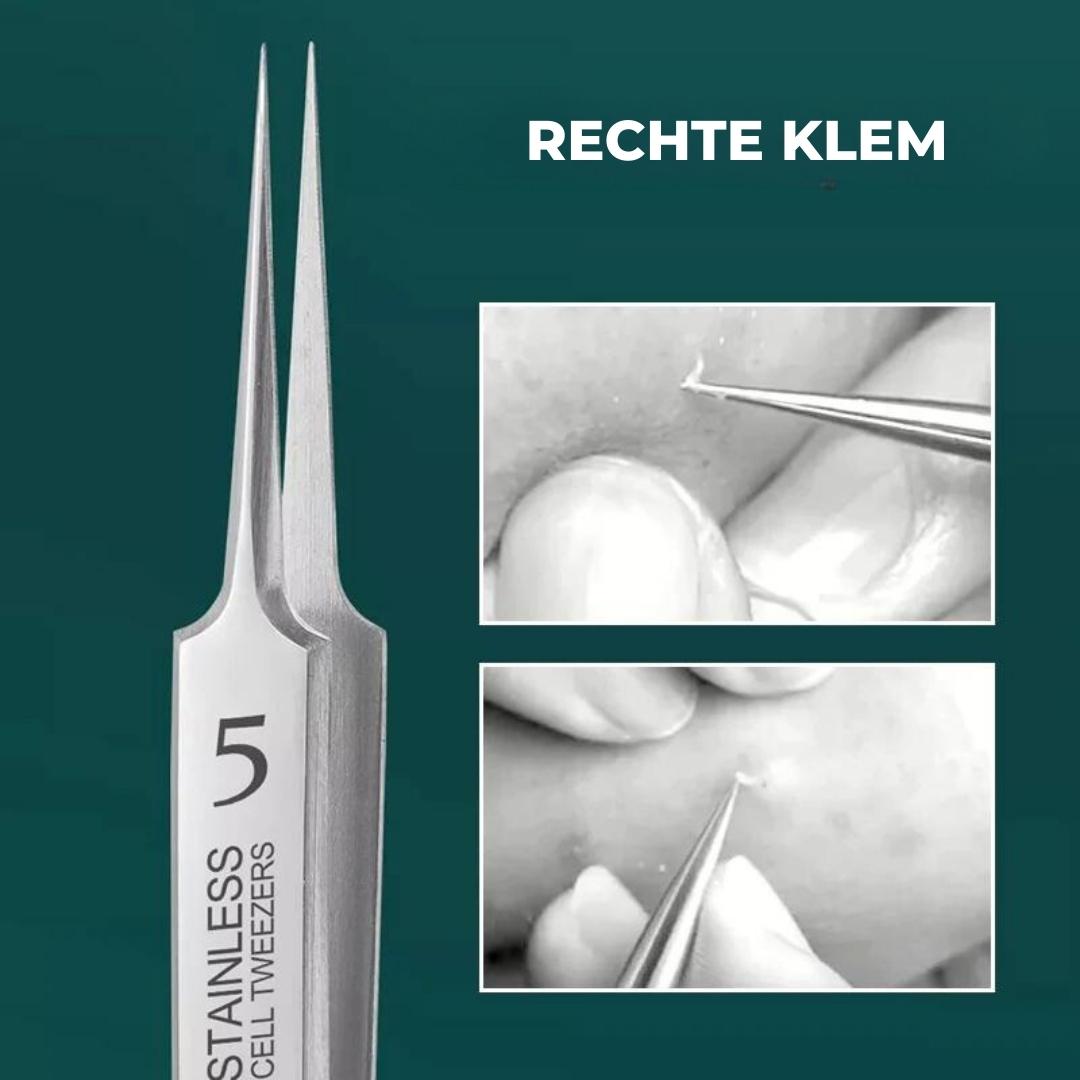 ClearSkin™ - Ultradunne mee-eter pincetten voor je gezicht